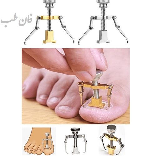 عکس محصول دستگاه ارتودنسی ناخن پا Nails